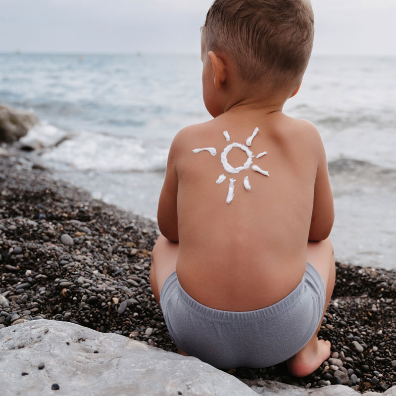 Hogyan védd kisgyermeked bőrét nyáron?